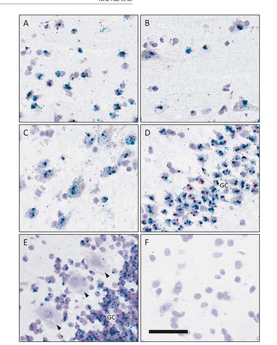 The psychiatric risk gene CACNA1C encode